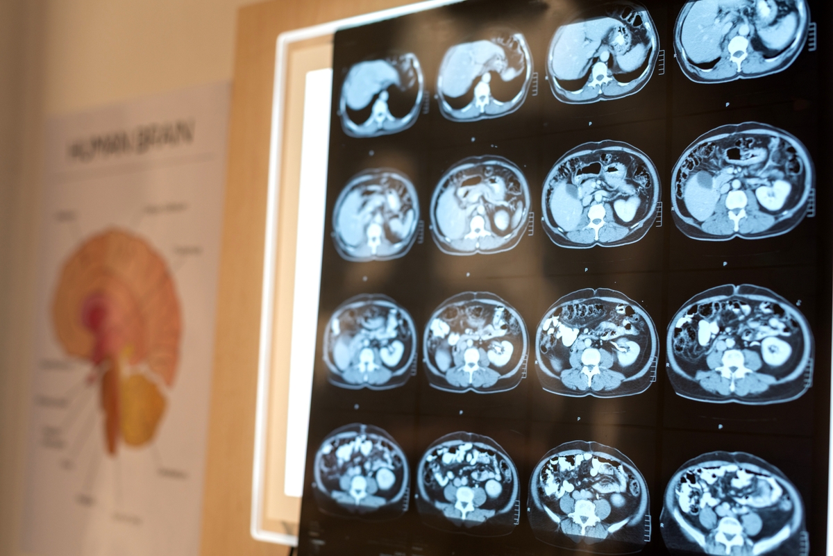 Imágenes clínicas de un cerebro