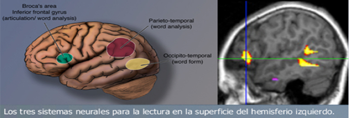 neuroimagen