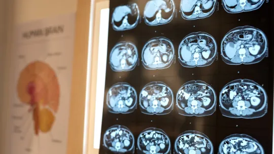 Imágenes clínicas de un cerebro