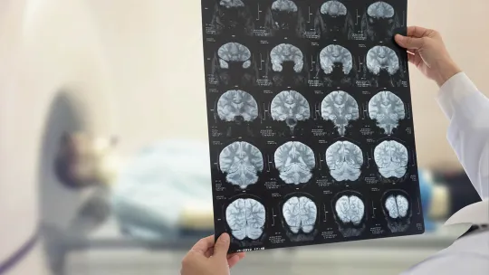 Máster Universitario en Neuropsicología.jpg Máster Universitario en Neuropsicología.jpg