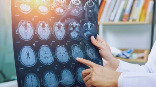 Experta en neuropsicología analizando imágenes de escáner cerebral Neuropsicóloga explica imágenes de un escáner cerebral, señalando áreas del cerebro durante un diagnóstico clínico