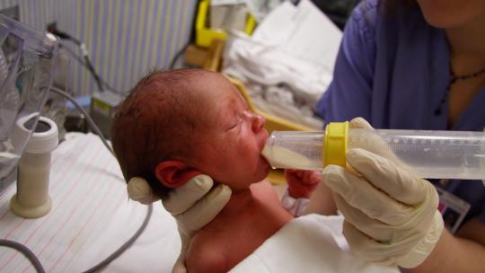 bebé prematuro siendo alimentado con un biberón