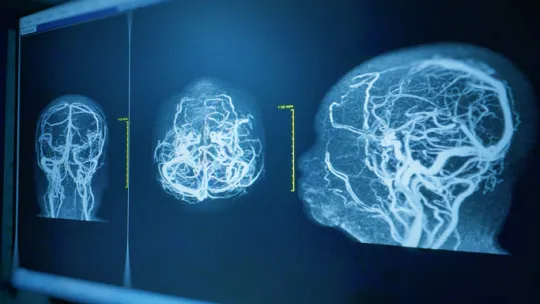 neuroanatomia funcional (1).jpg