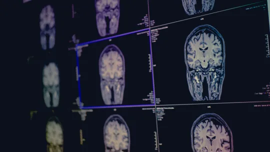 Masterclass evaluación neuropsicológica