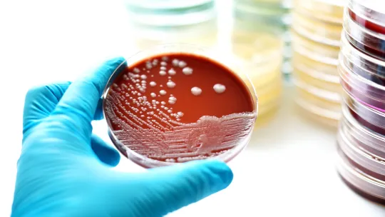 toxiinfección-alimentaria.jpg toxiinfección-alimentaria.jpg