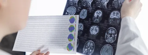 Máster en Neurociencias