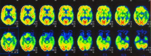 Premio Mejor Tesis Doctoral 2025 Cátedra VIU-NED header