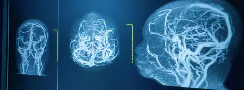 neuroanatomia funcional (1).jpg