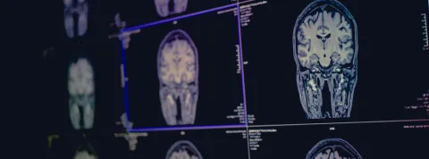 Masterclass evaluación neuropsicológica