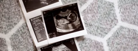 Rehabilitación Neurológica