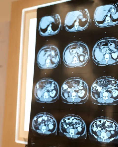Imágenes clínicas de un cerebro