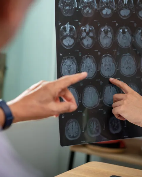 Imagen Portada MU Neurociencias