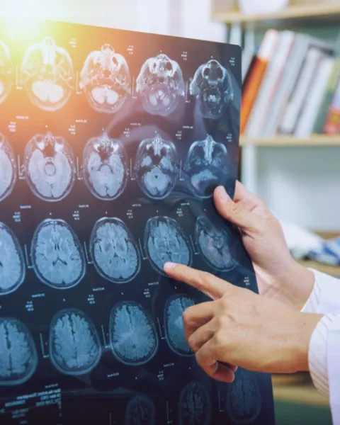 Neuropsicóloga explica imágenes de un escáner cerebral, señalando áreas del cerebro durante un diagnóstico clínico