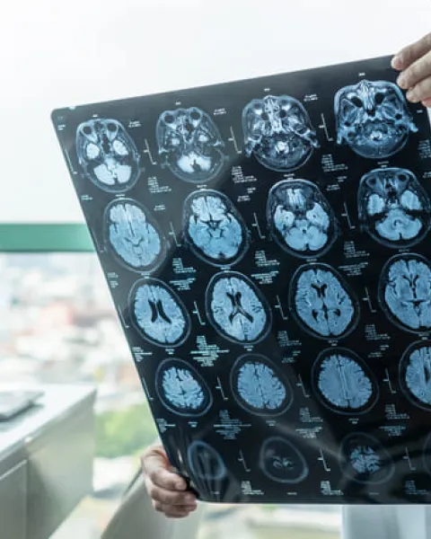 daño cerebral sobrevenido (1).jpg