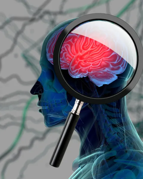 iStock-693840850.jpg