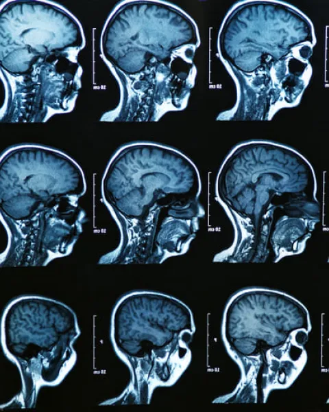neuroimagen (1).jpg