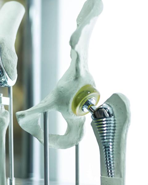 protesis-biomedica.jpg