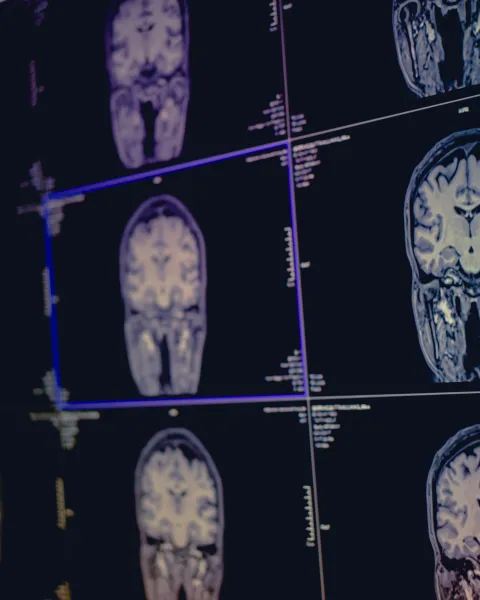 Masterclass evaluación neuropsicológica
