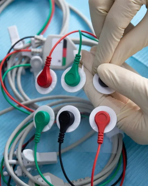 Imagen Portada Opciones terapéuticas en pacientes con dolor rebelde: Neuromodulación