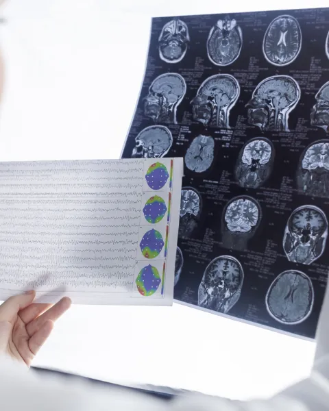Evento cátedra neurociencias