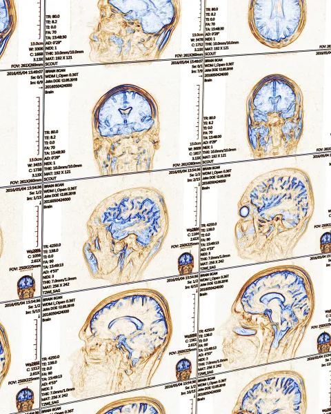 Portada III Jornadas de la Cátedra VIU-NED en Neurociencia Global y Cambio Social