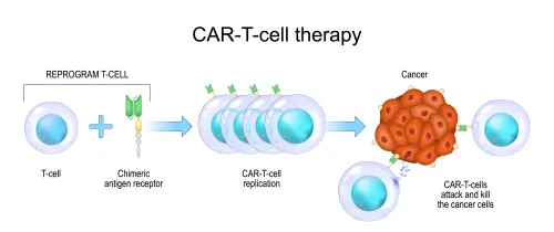 Esquema de terapia de células T con receptores quiméricos de antígenos (CAR-T) 